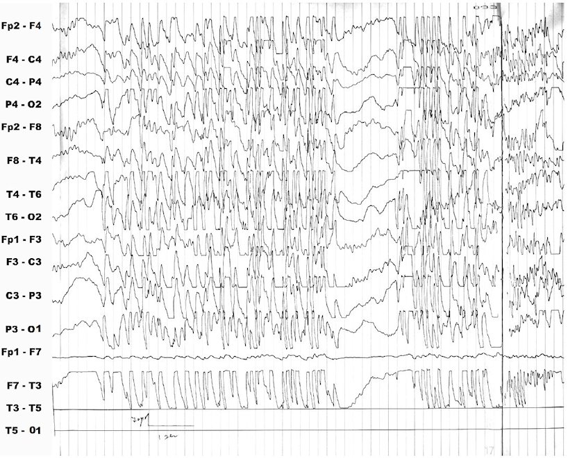 An external file that holds a picture, illustration, etc., usually as some form of binary object. The name of referred object is rmmj-3-1-e0005_Figure1.jpg